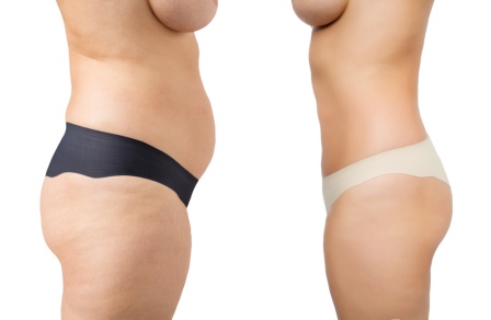 Paisley weight loss page image with two women